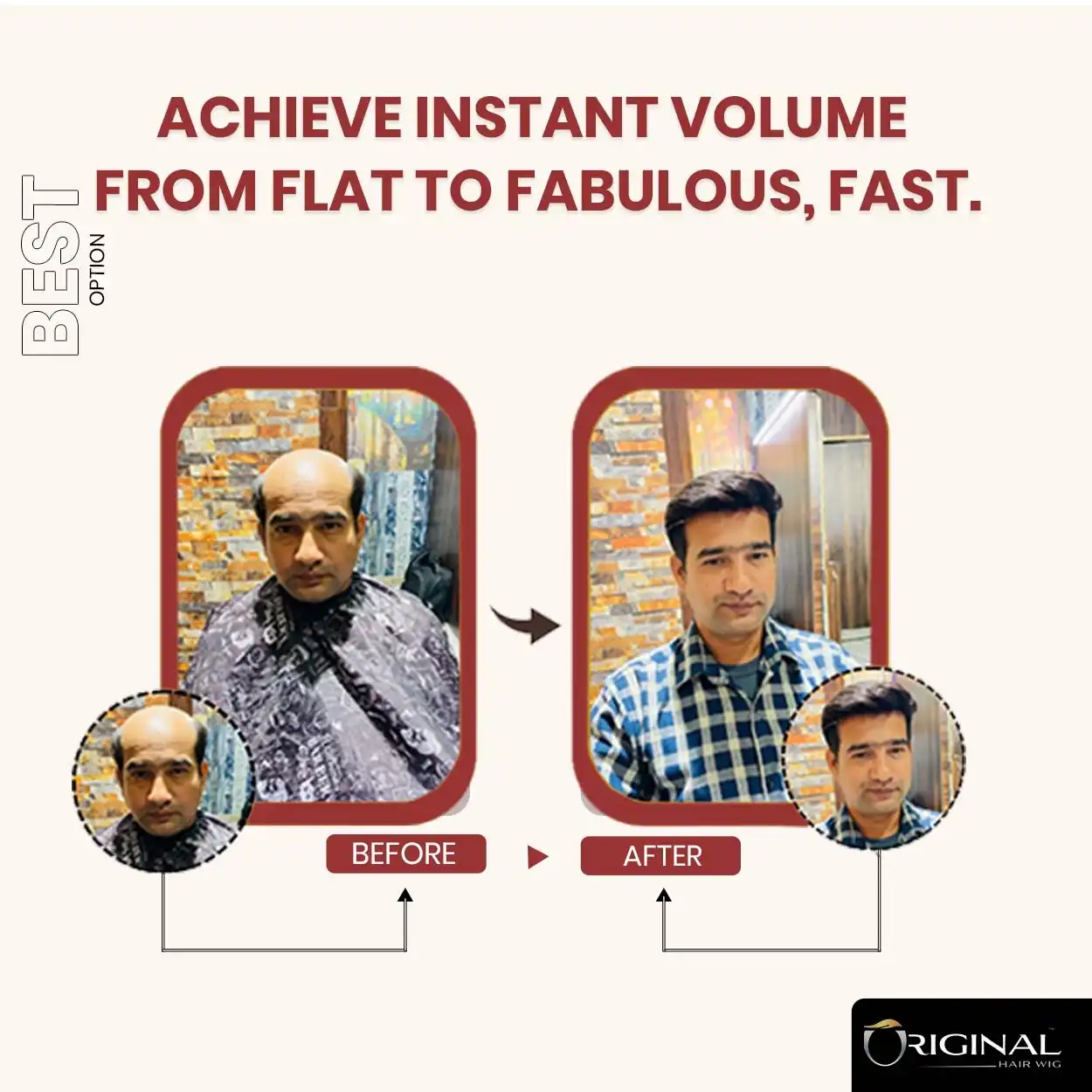 Golden Front Lace Hair Patch Single Base Strong Durable Hair System